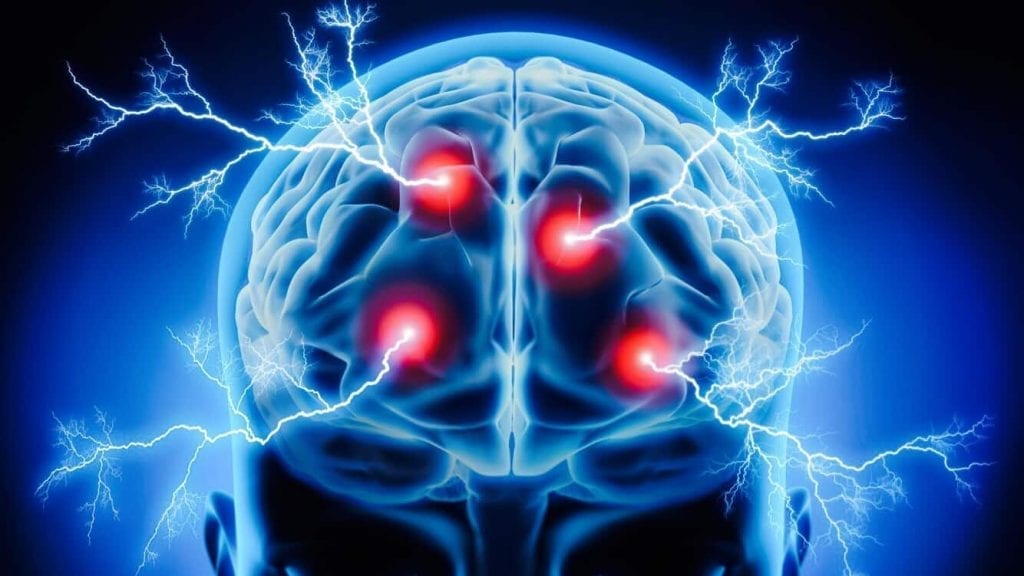 How Can Nootropics Help Gamers? 2 train brain more energy